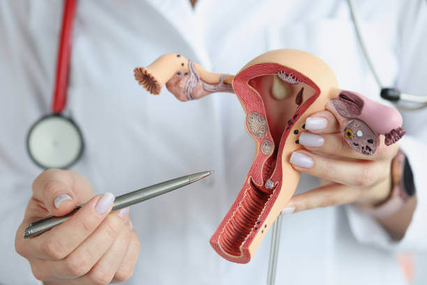 The doctor's hands hold a sectional model of the female reproductive organs, close-up. Training in gynecology and obstetrics